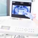 경화반점 이미지