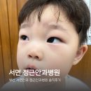 정근안과병원 | 부산 서면안과 정근안과병원 소아안과 아기눈병 검진후기