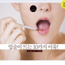 입술 트는 이유 10가지! 이미지