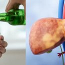 “소주 두 잔도 위험” 세계 인구 40%가 지방간에 시달리는 중 이미지