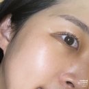 위드미괴정협진점 | 색소 패키지 주근깨 레이저 치료 중 (2) :: 토닝레이저, 재생 리페어 크림 추천(JK위드미 EGF리페어크림)