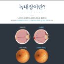 타임안과의원 네이버블로그
