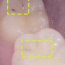 송탄바른치과의원 이미지