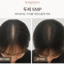 미우아카데미 라인 | 반영구 종류 , 부작용｜눈썹 아이라인 입술 헤어라인 관리법