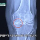 소나무정형외과의원 네이버블로그