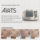 티에스 메디칼 이미지