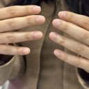 11590-마36-3 | 드디어 찾은 물어뜯는손톱 한번에 해결하는방법 - 대구아크릴연장전문 "람페로마" 물뜯손 교정 후기