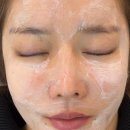 이온메디칼 | 평택 피부관리 N바디브라운 | 기미 잡티 관리 받고 온 후기