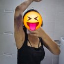 잠실나루 | 잠실나루 팔 지방추출주사 1주일 후기 - 부작용은? 일상생활 가능할까?