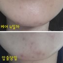 (주)허브큐어 - 1620 | 스킨클리닉 헬릭실 크림~! 트러블과 트러블 후 붉음 개선, 그리고 탄력까지 지켜주는 인생 피부재건...