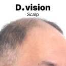 디비전 스칼프 이미지