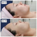 중원하대원-D-1 | 하대원 올가드림뷰티 추천 모공디톡스 관리 후기