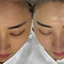 리움 | 파주 피부관리 맛집 H.뷰티리움 후기