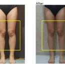 36.5체온다이어트 이미지