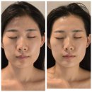 상정로 | 부평작은얼굴관리✨ 두상부터 달라지는 단아비책부평점 리얼후기