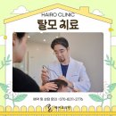 금산새미래의원 | 동탄 헤어로의원 모발이식 2인 협진의 결과