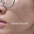 ㈜하니케어 | 미백화장품 추천 | 셀락바이오 화이테오라 멜라 5D 세럼 솔직 후기