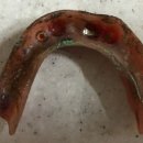 참진치과기공소 이미지