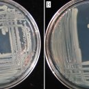 Ampicillin-dextrin agar에서의 A. hydrophila와 A. sobria 이미지