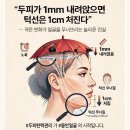 두피탈모관리