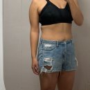 부산제일의원 | 부산지방추출주사 걱정했지만 살빠진 내돈내산 후기