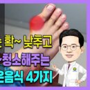 통풍에 좋은 음식 요산수치 낮추는 방법 이미지
