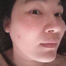 스킨아이다루피노(하단본점) | 하단에스테틱 스킨아이다루피노 수분가득 물톡스테라피 후기