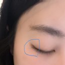 래쉬티비 | MD속눈썹영양제 발모제 내돈내산 한달 사용 후기, MD래쉬팩터 효과 솔직 리뷰