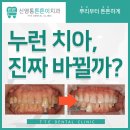 하얗게 웃고 싶다면? 신영통치과 치아미백 후기가 말해줍니다