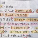 린네검사 감각신경성 난청 이미지