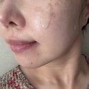 에이징팩토리 | 피부 끝까지 침투하는 첫 단계 케어 : 더마팩토리 프로EGF 플렉시어좀 슬로우에이징 에센스 솔직 사용 후기