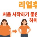 하이퍼짐 이미지