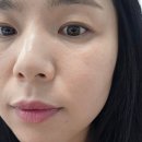 뽀샤시(c) 피부관리 | 40대 피부관리 시작| 비타민C 앰플 4일 사용 후기 (+ 홈케어 루틴 공개)