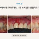 하늘치과기공소 이미지