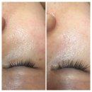 스마일쏠라 | [뷰티]안산 쏠라잇 피부관리 내돈내산 솔직후기