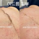 뉴세라