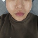 부산양정동우체국 | 부산 연산동피부관리 에르에스테틱 에서 고주파 리쥬스템셀관리 받고 브이라인 모공 잡은 후기