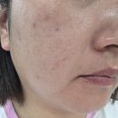썬카클리닉 | 담톤 수분진정시카선크림 후기 :) 민감피부도 편했던 촉촉 선크림 추천
