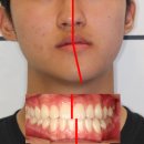 강남드림내과의원 | 안면비대칭 마사지 진짜 효과 있나? 논문 봤더니