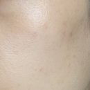 상미초등학교 | 부천 피부 색소 미백 관리 후기｜부천 모공 관리 + 부천 기미 관리까지 가능한 써니뷰티