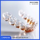 세련치과기공소 | 청주금천동치과추천 치아교정 후 얼굴형이 바뀐다는 말, 사실일까?