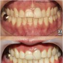 이-라인치과기공소 이미지