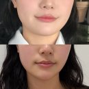 영통고가밑 사거리 | [끌리메 창원점] 창원 상남동 에스테틱 창원 비대칭 얼굴 경락 웨딩관리 추천