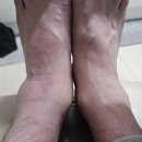 봄봄약국 | 약국에서 구매한 하루온 쿨팩 핫팩 통증부위 완화