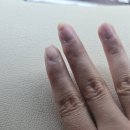 주식회사 숨앤케어 | 마두네일 찾다가 다녀온 에그래쉬앤네일, 손상 손톱 기본 케어 후기