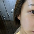강남 K레티시아 에스테틱 솔직후기, 정밀 진단 후 맞춤 디톡스 케어