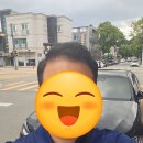 압구정어린이집 | 압구정 모발이식: 모빈치의원에서 1년만에 리터치 후기(사진O)