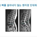 닥터-Q