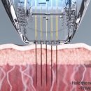 시크릿의원 이미지