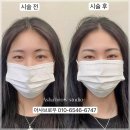 이미지-또 하나의 | 부평눈썹문신 후기 깔끔하고 예쁘게 정리한 이미지